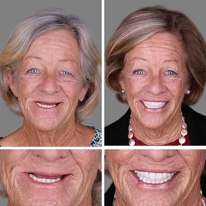 🔥3,155 sold in last 24 hours🔥⏰ Medical Full Denture with Strong Suctiond🦷Obtain American Dental Association (ADA) Certification