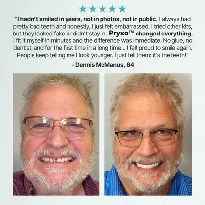 🔥3,155 sold in last 24 hours🔥⏰ Medical Full Denture with Strong Suctiond🦷Obtain American Dental Association (ADA) Certification